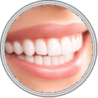 Teeth Whitening